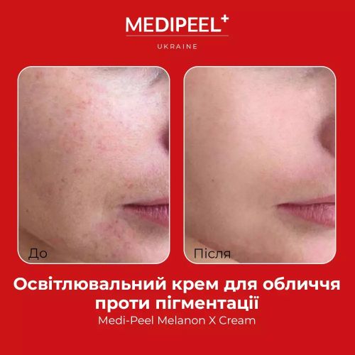 Medipeel MELANON X CREAM POUCH в саше  1.5ml