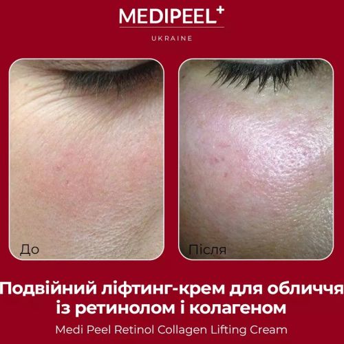 Medipeel Подвійний ліфтинг-крем з ретинолом і колагеном 50 мл