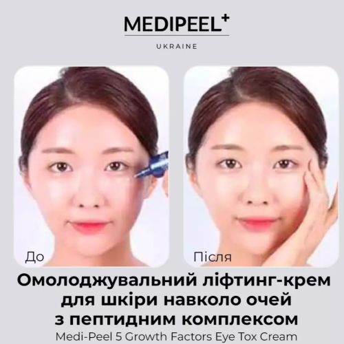 Medipeel Крем для шкіри навколо очей Eye Tox Cream Wrincle Care 40ml
