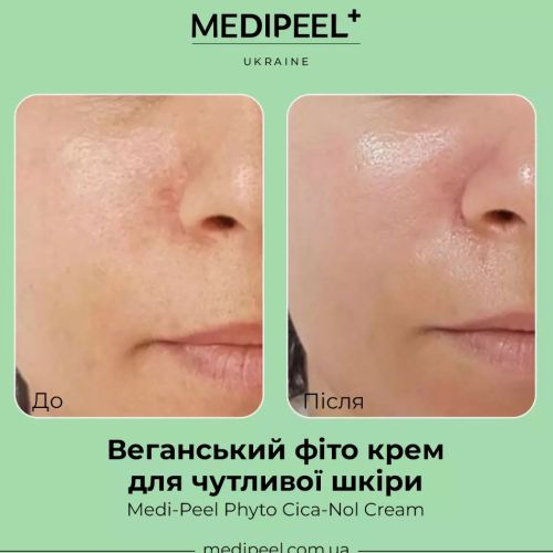 Medipeel Крем /PHYTO CICA-NOL CREAM