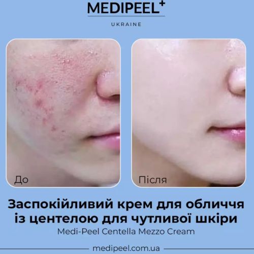 Medipeel крем центелла 30мл/CENTELLA MEZZO CREAM
