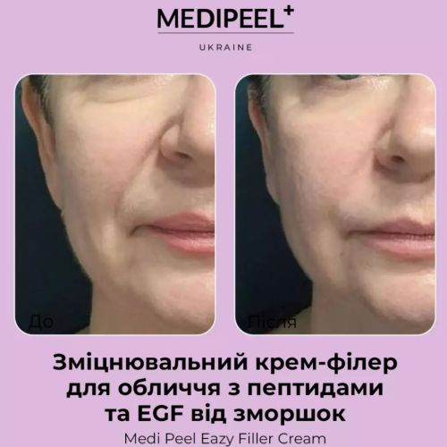 Medipeel Wzmacniający krem ​​wypełniający do twarzy z peptydami i EGF na zmarszczki Eazy Filler Cream 50 g
