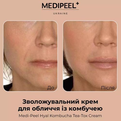 Medipeel Moisturizing cream with kombucha 50ml/HYAL KOMBUCHA TEA-TOX CREAM