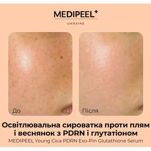 MEDIPEEL Young Cica Освітлювальна сироватка з PDRN і глутатіоном проти плям і веснянок PDRN Exo-Pin