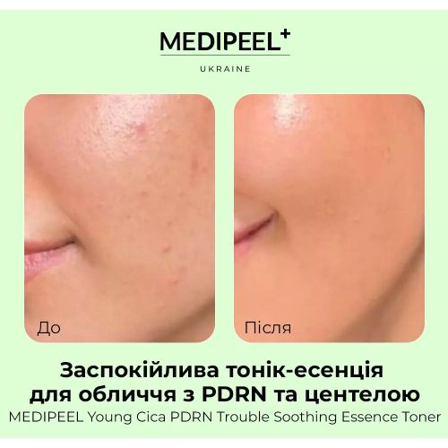 MEDIPEEL Young Cica Soothing Facial Toner Essence z PDRN i Centella PDRN Trouble Soothing