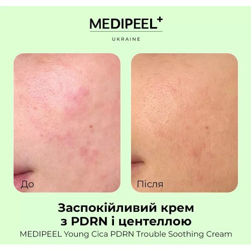 MEDIPEEL Young Cica Заспокійливий крем з PDRN і центеллою PDRN Trouble Soothing Cream, 80 ml