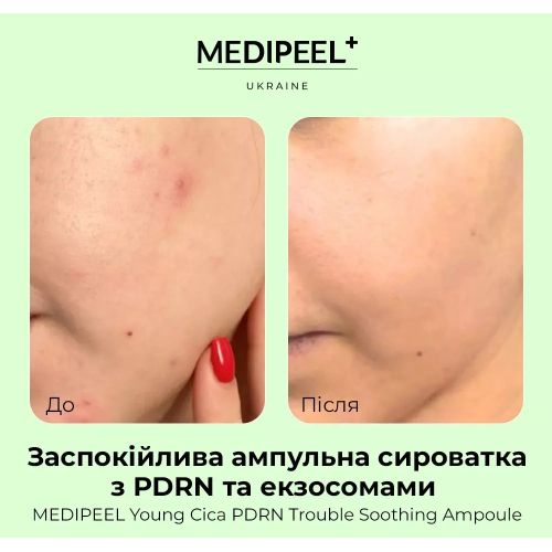 MEDIPEEL Young Cica Заспокійлива ампульна сироватка з PDRN та екзосомами PDRN Trouble Soothing Ampou