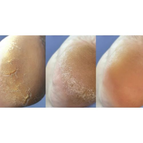 NAILSOFTHEDAY Крем від тріщин для ніг та рук, 30 мл 