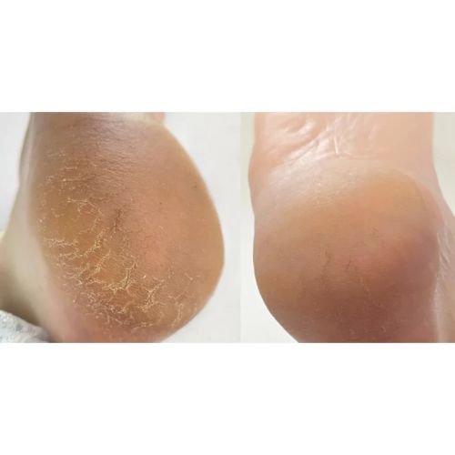 NAILSOFTHEDAY Крем від тріщин для ніг та рук, 30 мл 