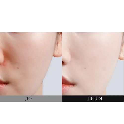 Сонцезахисний освітлювальний крем з пробіотиками Dr.Ceuracle Pro Balance Biotics Clear Up Sun SPF 50+ PA++++ 50 ml