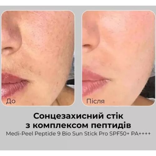 Сонцезахисний стік з комплексом пептидів MEDIPEEL Peptide 9 Bio Sun Stick Pro SPF50+ PA++++, 19 гр