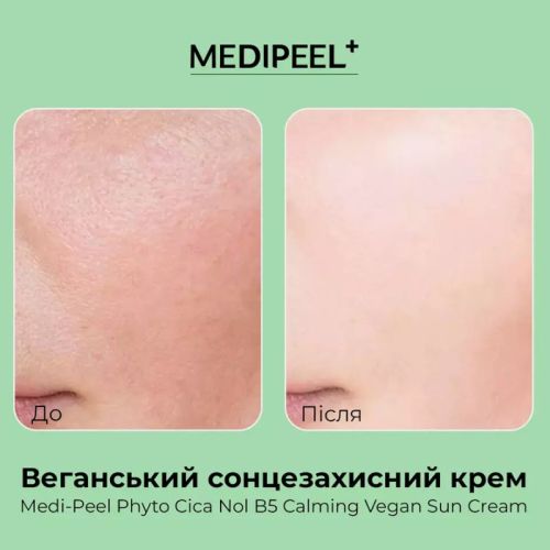 Веганский солнцезащитный крем MEDIPEEL Phyto Cica Nol B5 Calming Vegan Sun Cream, 50 мл