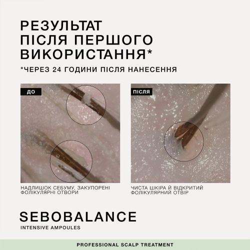 Балансирующая сыворотка в ампулах для кожи головы, склонной к жирности, Triology 5шт*5ml