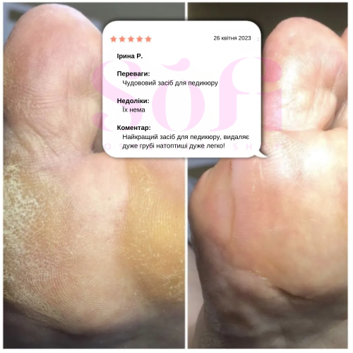 Ремувер для кутикули Salu, 50 мл